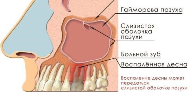 ÐÐ°ÑÑÐ¸Ð½ÐºÐ¸ Ð¿Ð¾ Ð·Ð°Ð¿ÑÐ¾ÑÑ Ð¡Ð¸Ð½ÑÑÐ¸Ñ