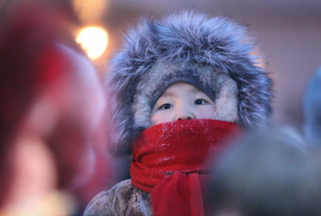 Больные зубы могут стать причиной гайморита.
